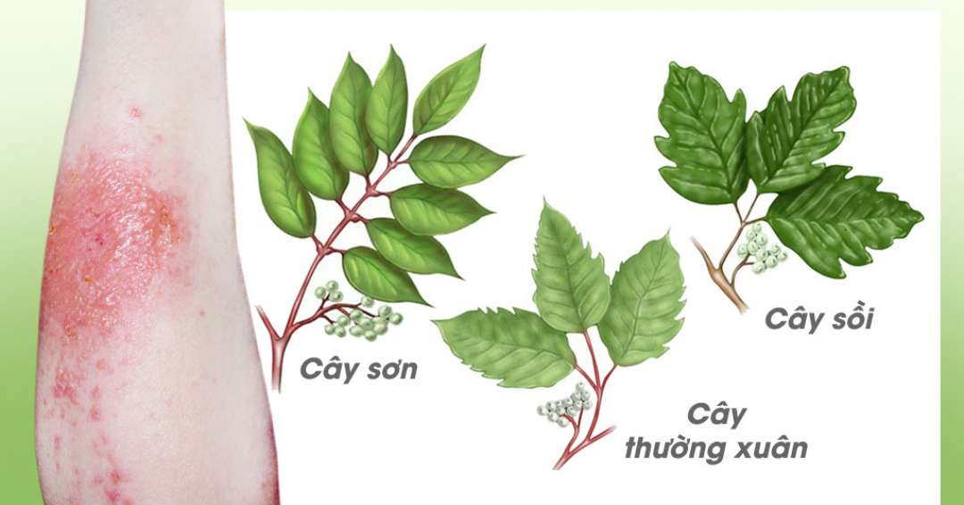 Hình ảnh cây sơn độc