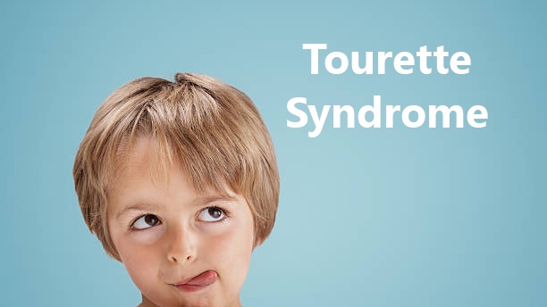 Tourette là gì?