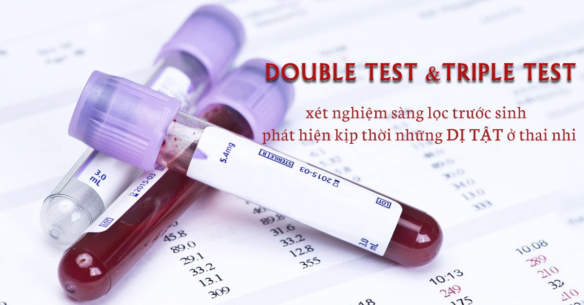 Tìm hiểu thông tin double test là gì?