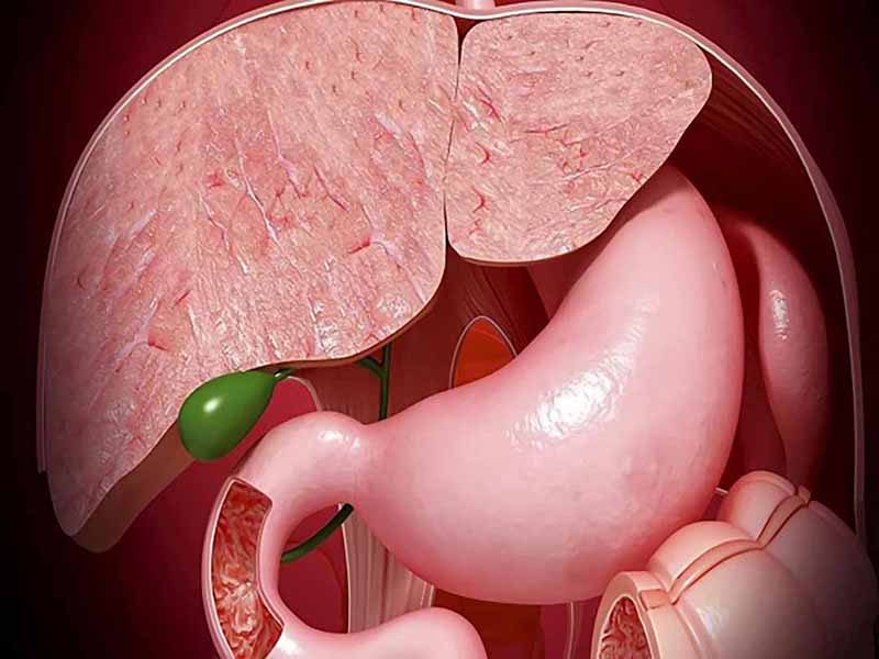 Nguyên nhân bị polyp túi mật